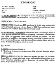 Normal Eeg Report Sample - mapasgmaes