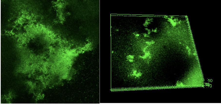 biofilm understress and underflow
