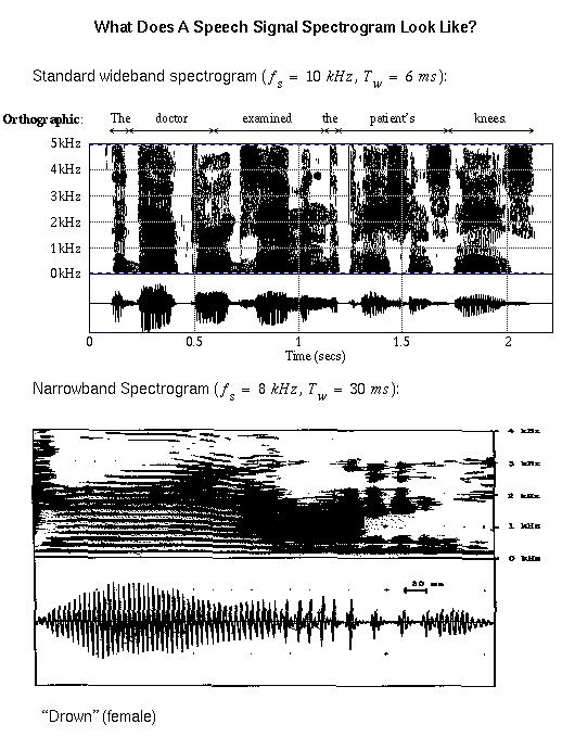 Speech signal spectrogram